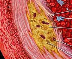 ������ �������� �������� ����������